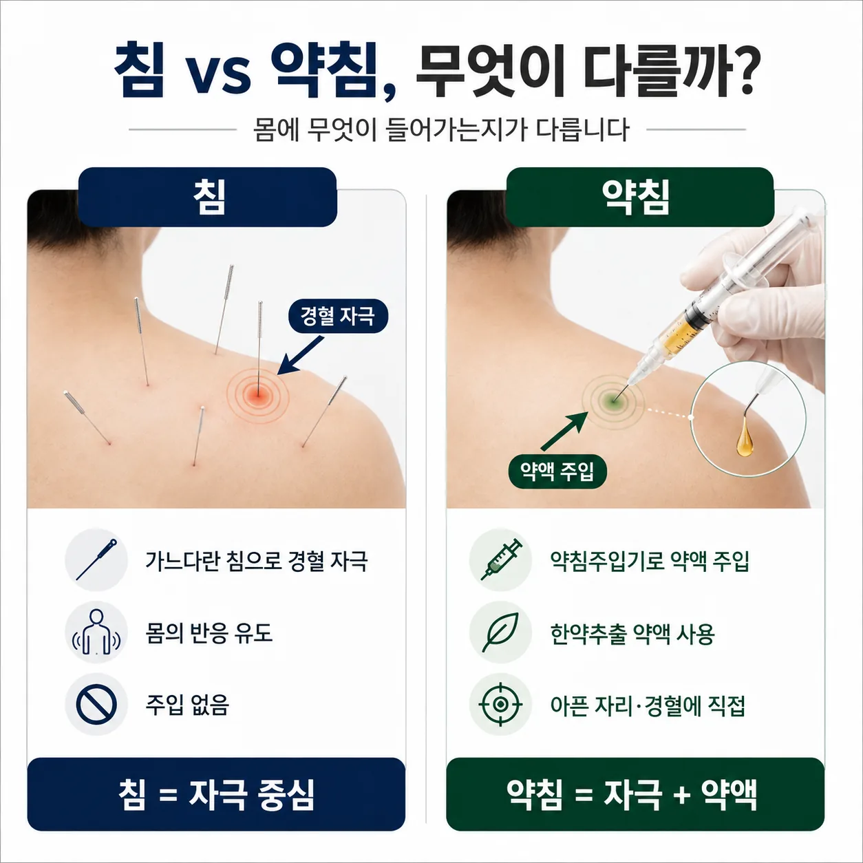침과 약침의 차이를 비교한 도해