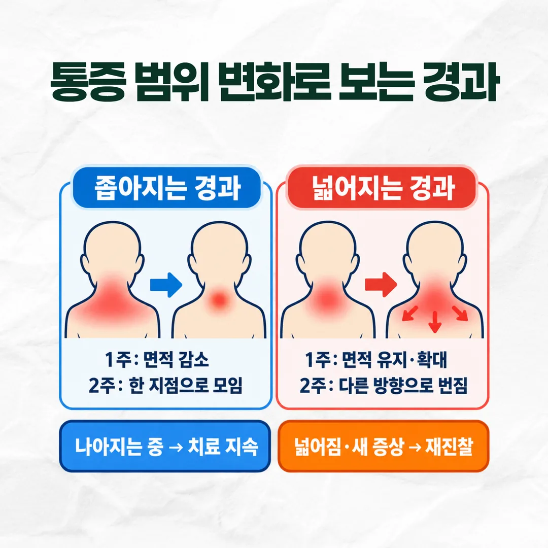 교통사고 뒤 통증 범위가 좁아지는 경과와 넓어지는 경과를 나란히 비교한 그림