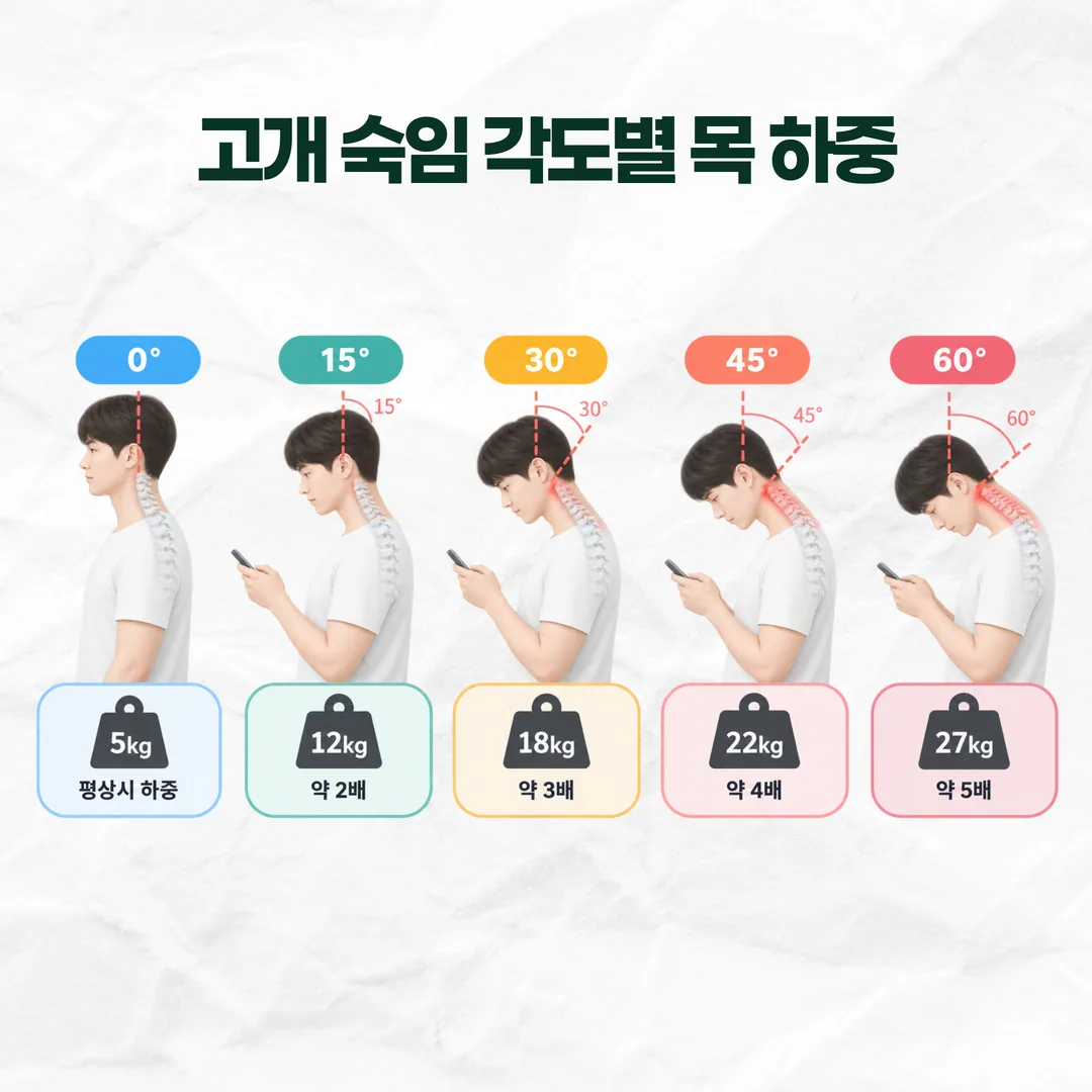 고개 숙임 각도별 목 하중이 5킬로그램에서 27킬로그램까지 커지는 것을 나타낸 막대 그래프