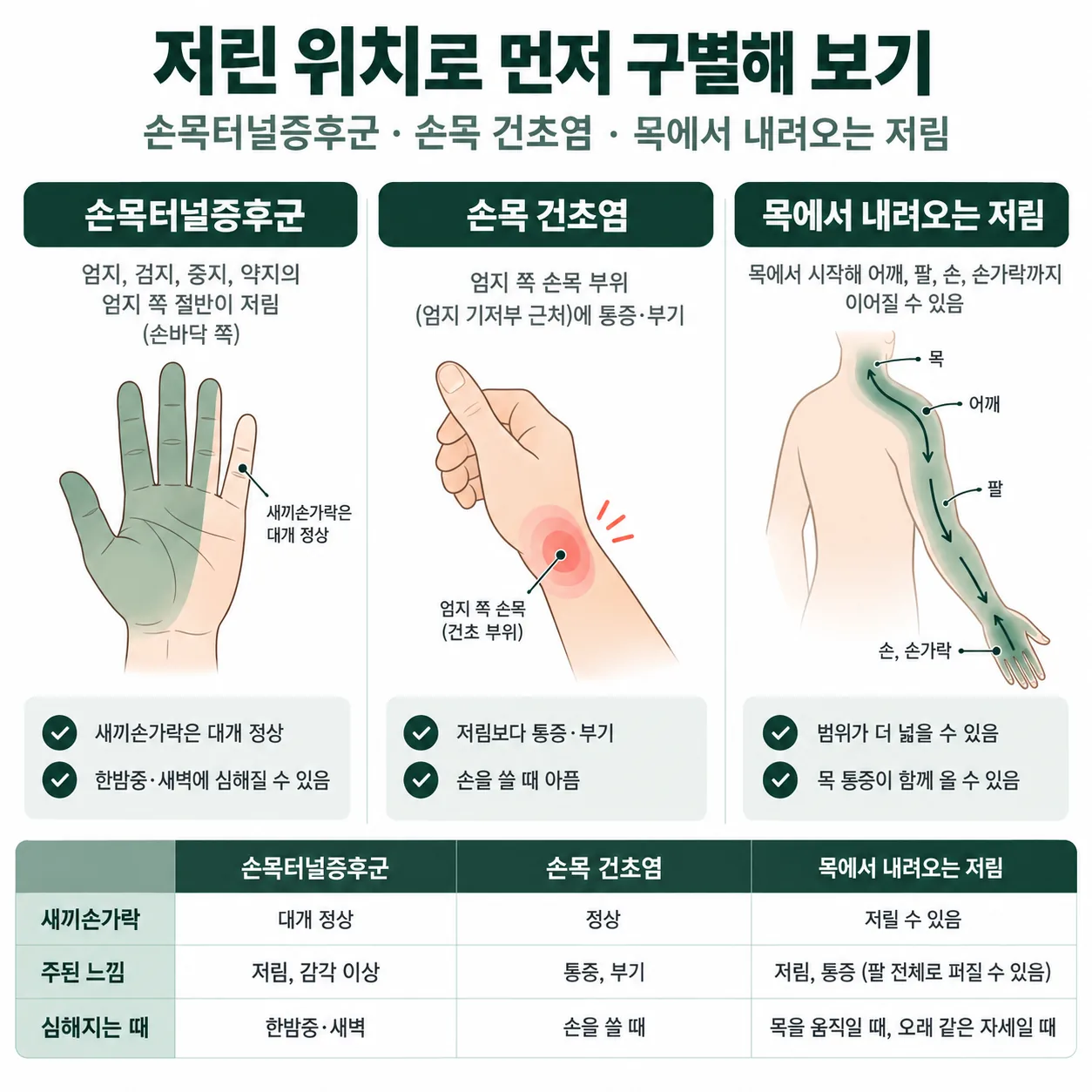 세 가지 손 저림의 분포 범위를 손 그림으로 비교한 그림