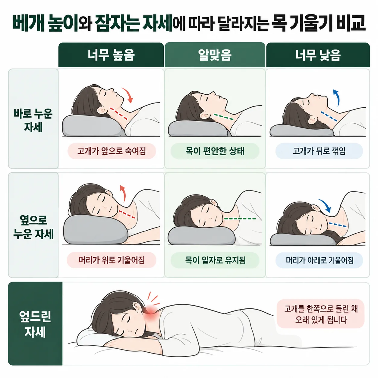 베개 높이와 바로 눕기, 옆으로 눕기, 엎드리기 자세에 따라 달라지는 목 기울기 비교 도식