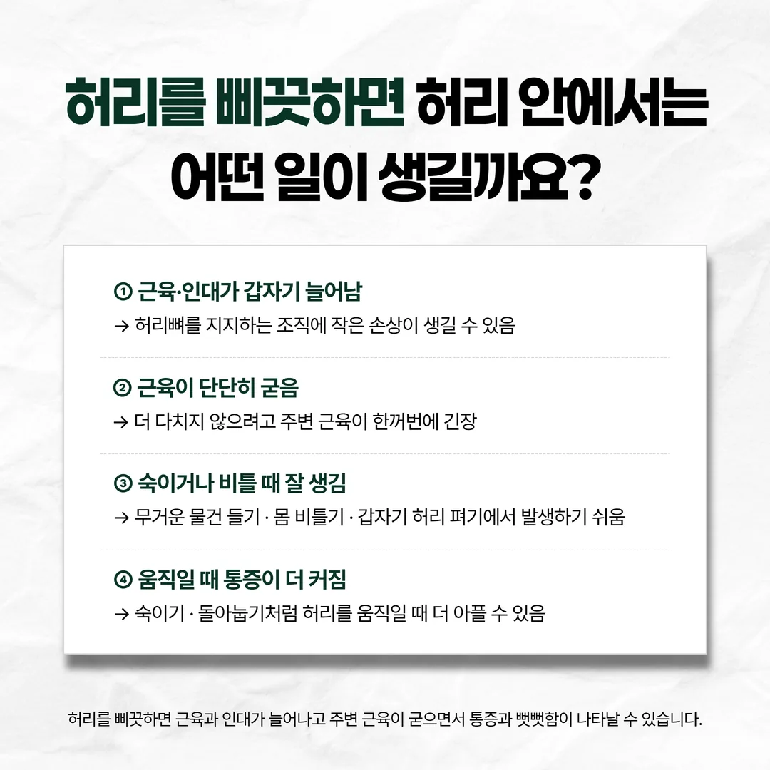 허리를 삐끗할 때 늘어난 인대와 굳은 허리 근육을 표시한 요추 염좌 개념도